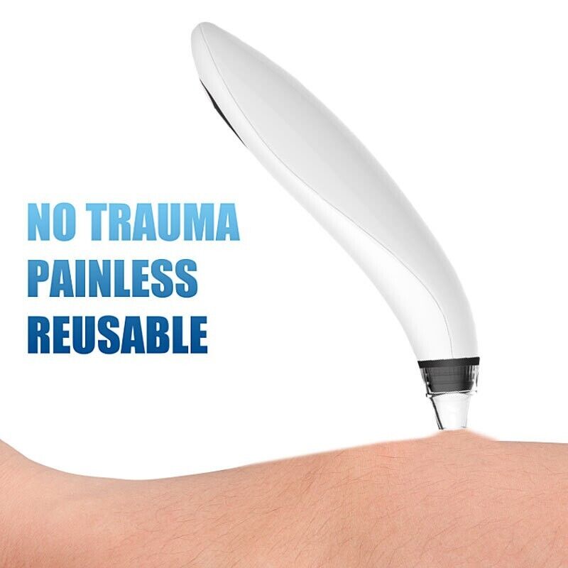 Electric Blackhead Remover Cleaner Face Diamond Pore Vacuum Suction - Shopiville